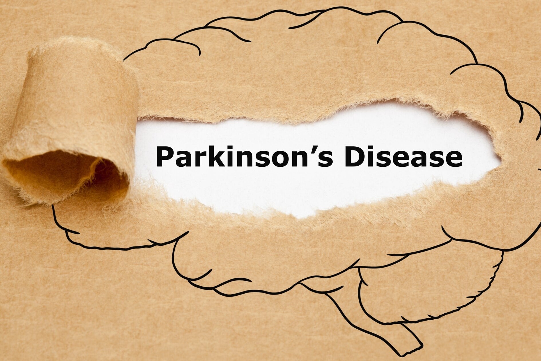 All You Need To Know About Parkinsons Disease