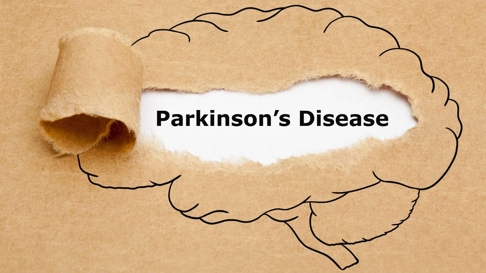 All You Need To Know About Parkinsons Disease