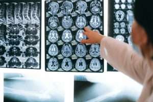 All about Traumatic Brain Injury