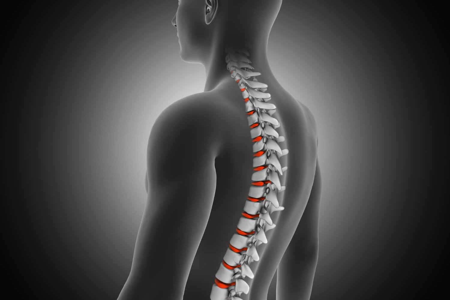 Spinal Stenosis Risk Factors & Diagnosis | Dr.Chandril Chugh