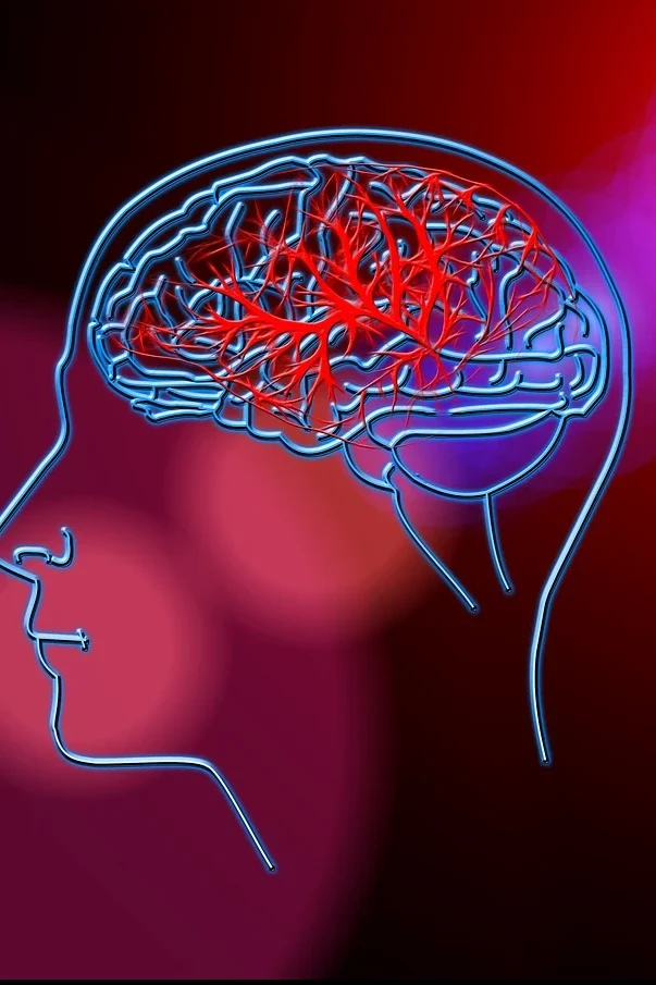 brain stroke treatment 1 brain stroke treatment