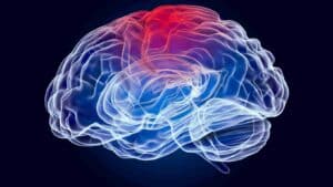 Can Stress Cause Brain Tumors? Revealing the Truth Behind the Myth 4 Brain attack