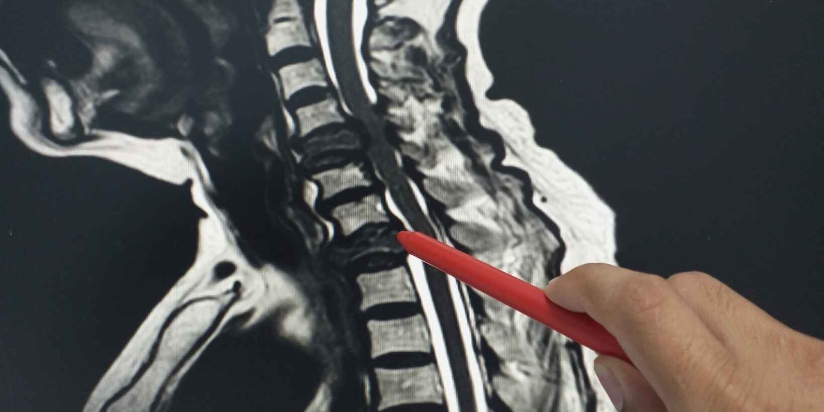 Navigating the Complexity of Spine Surgery