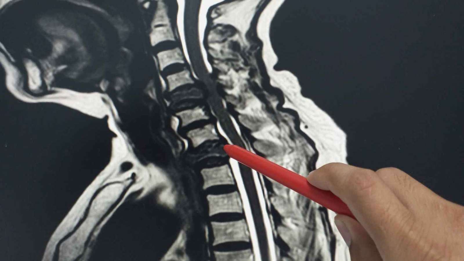 Navigating the Complexity of Spine Surgery