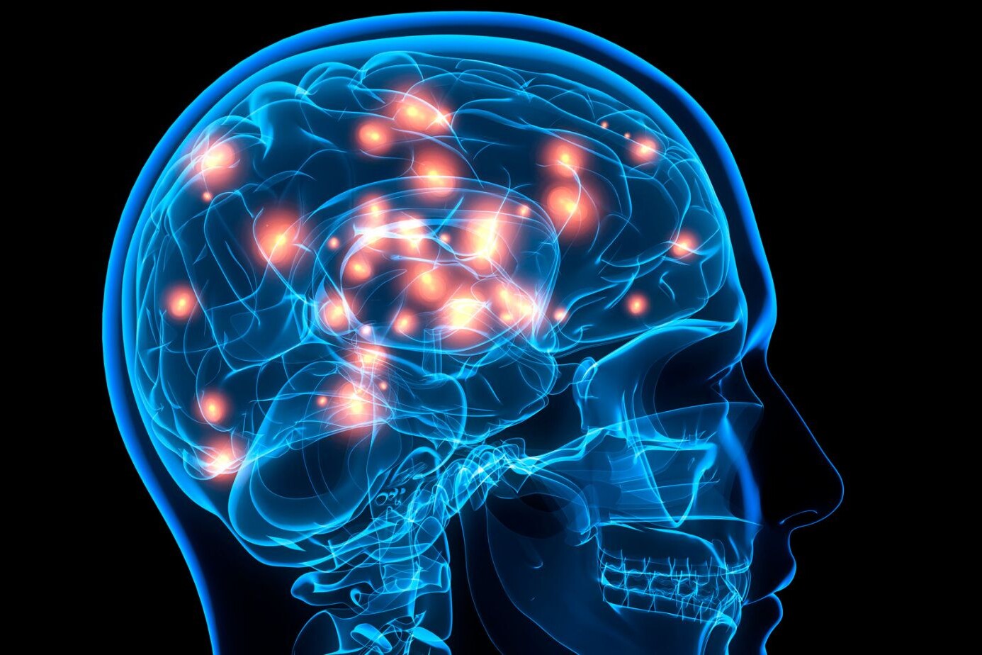 Neuroradiology How Can It Benefit You