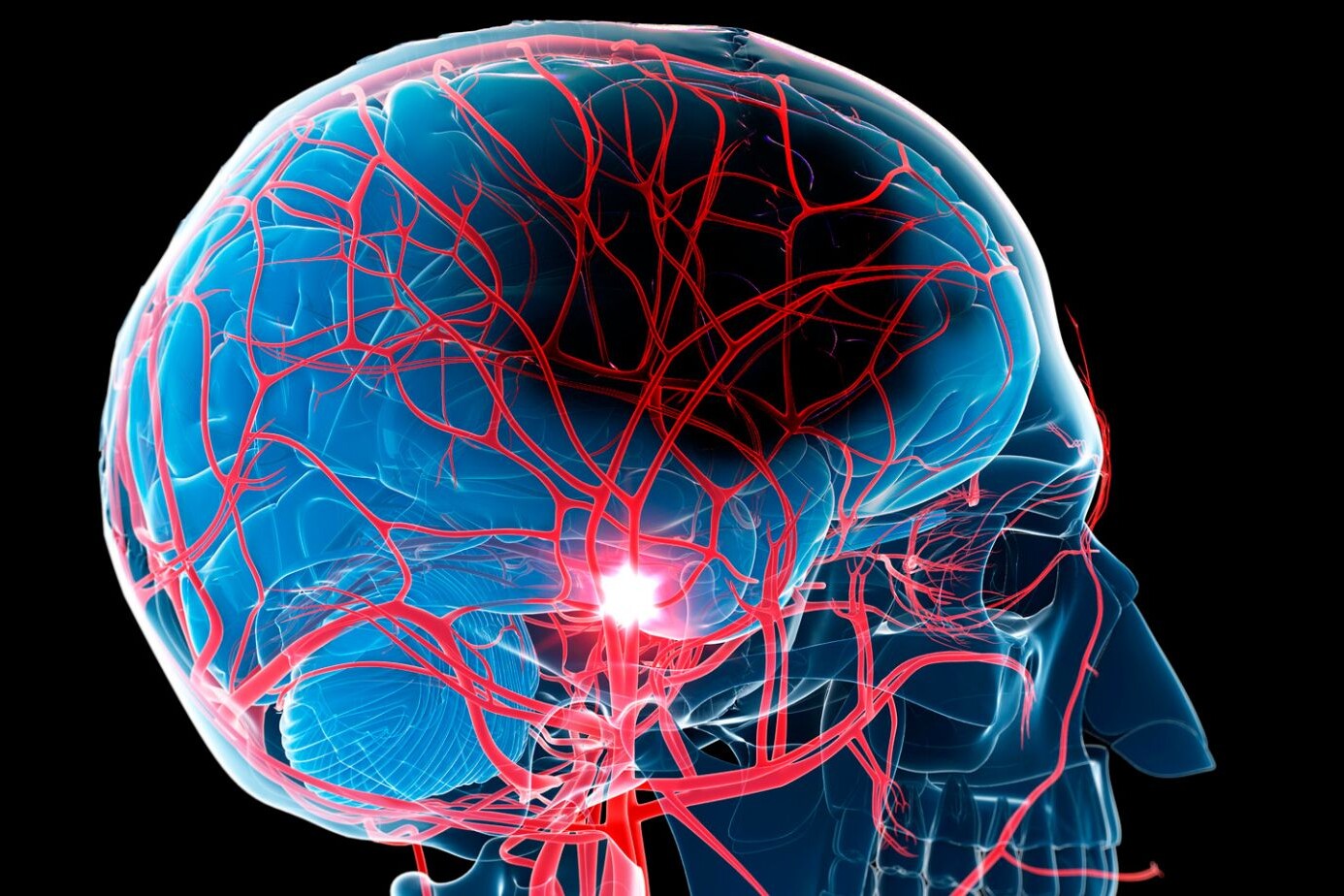 Understanding Stroke: A Simple Guide for Everyone 3 ischemic stroke management guidelines, Understanding Stroke A Simple Guide for Everyone