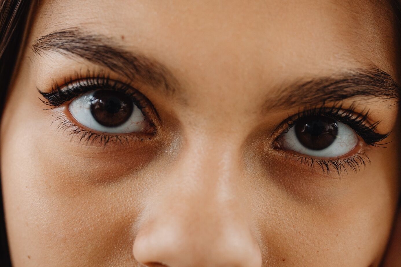 bell's palsy symptoms