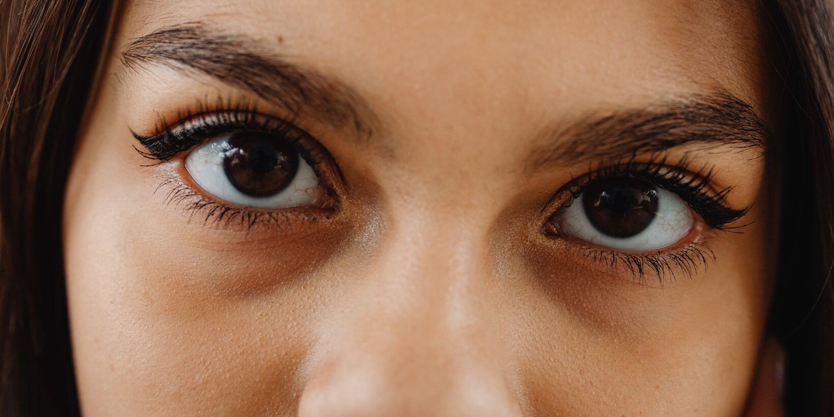 bell's palsy symptoms