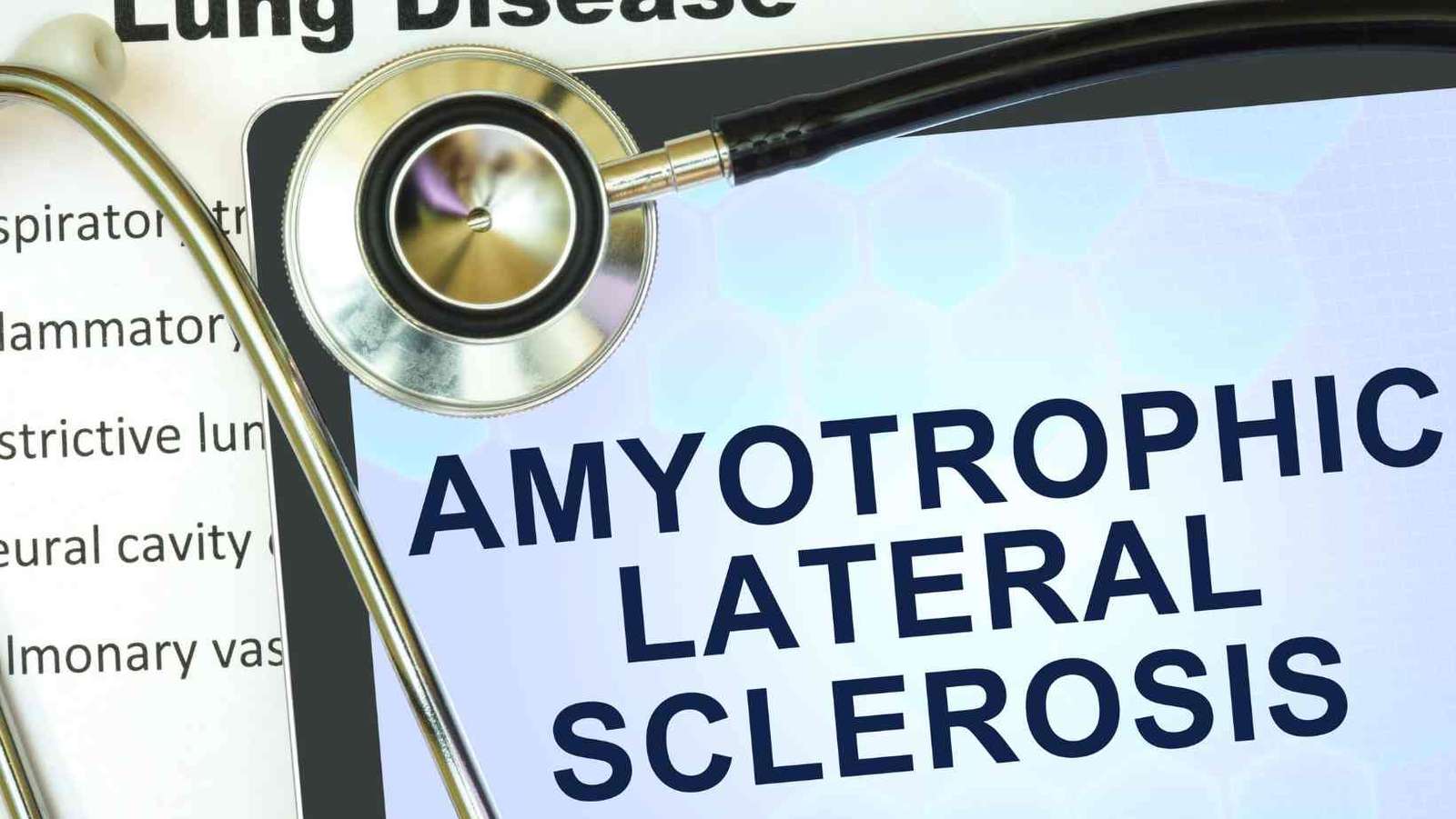 amyotrophic lateral sclerosis symptoms