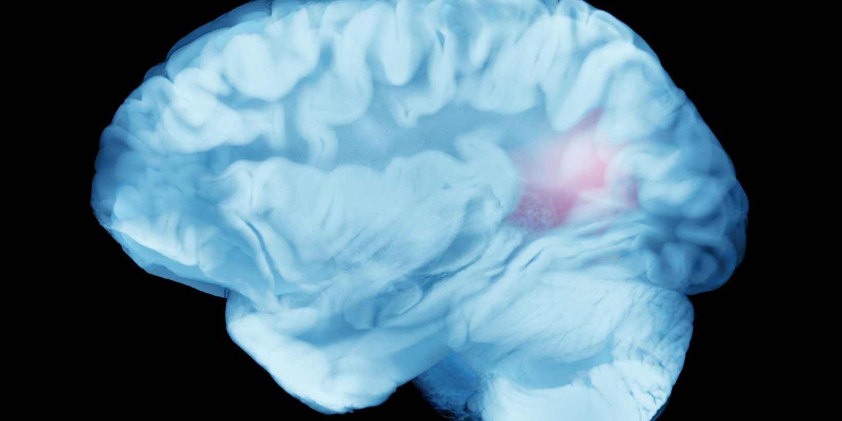 Treatment of Brain Hemorrhage