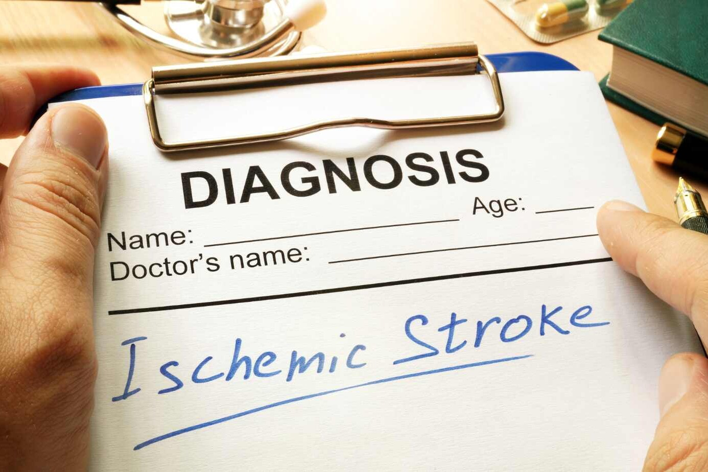 Recognizing Ischemic Stroke Symptoms: What to Look For 6 Recognizing Ischemic Stroke Symptoms: What to Look For