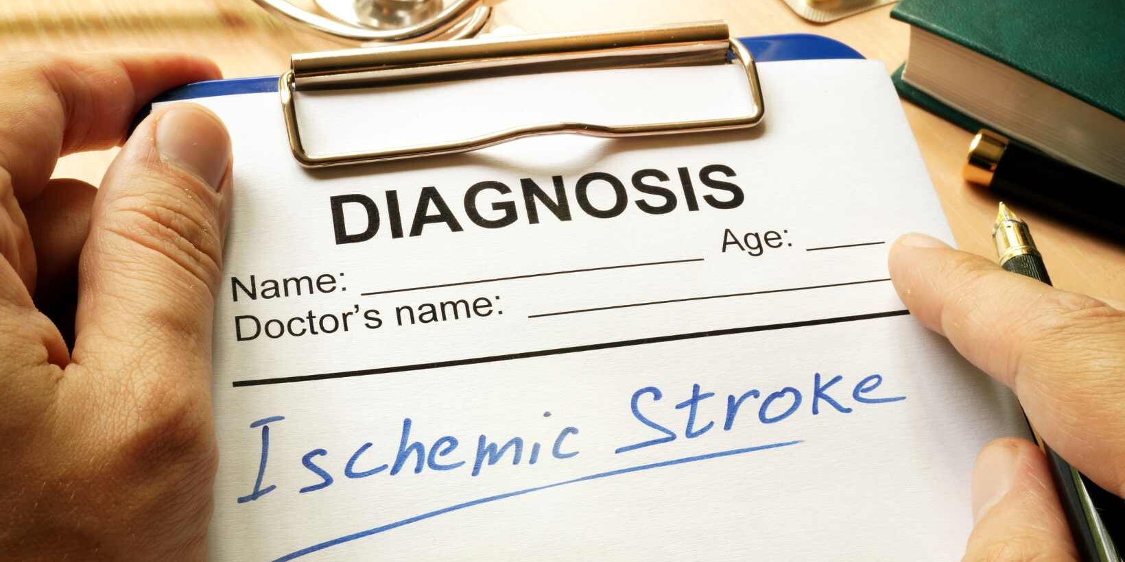 Recognizing Ischemic Stroke Symptoms: What to Look For