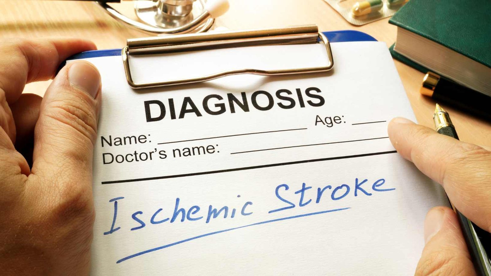 Recognizing Ischemic Stroke Symptoms: What to Look For