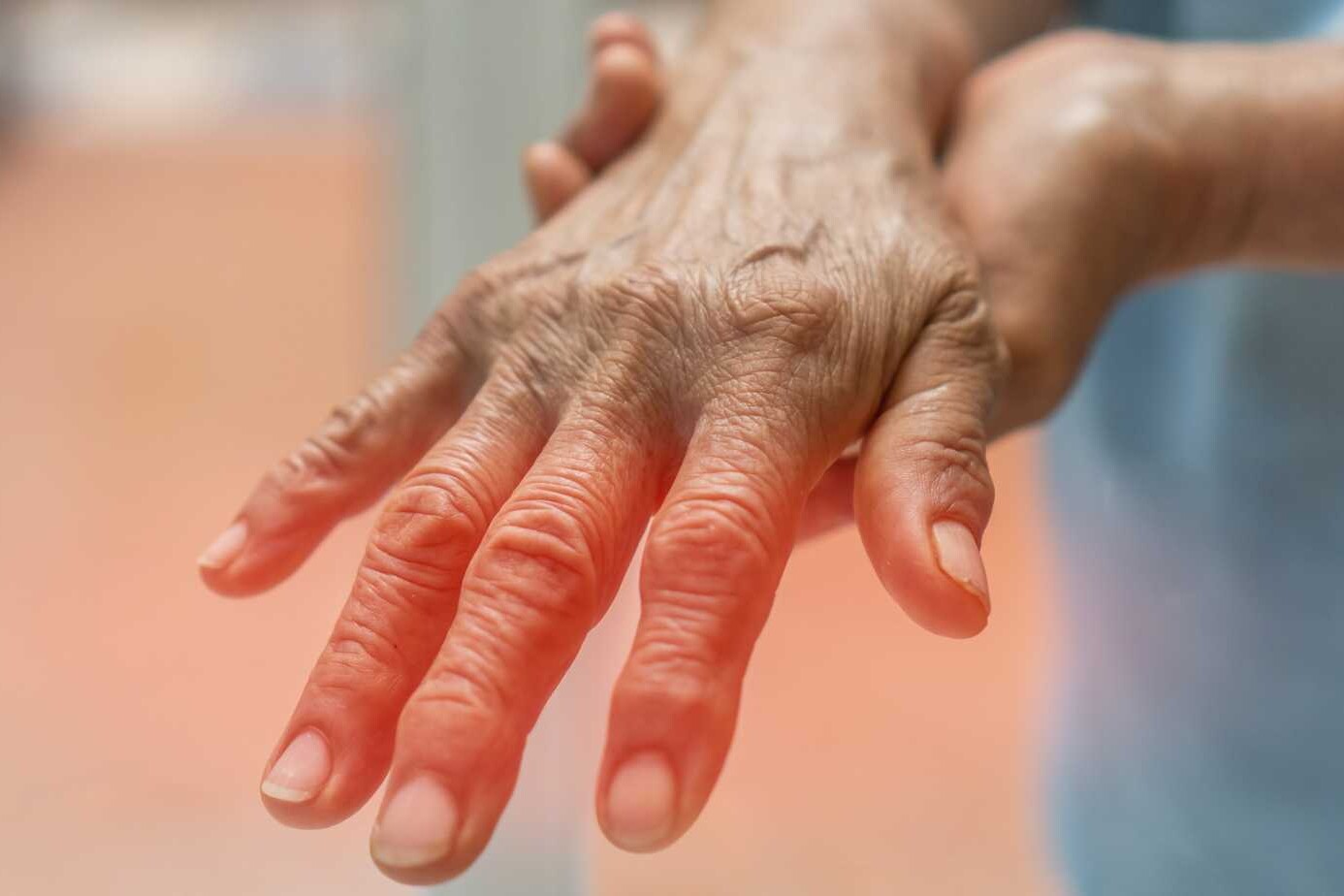 Signs and Symptoms of Hemiplegia: What to Look For 4 Signs and Symptoms of Hemiplegia What to Look For