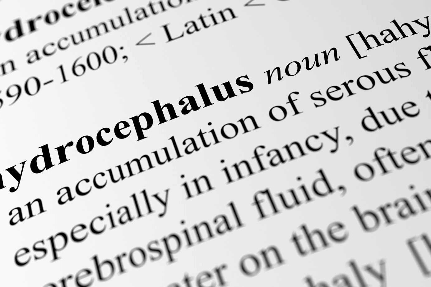 What is Hydrocephalus? Understanding the Condition 3 What is Hydrocephalus? Understanding the Condition