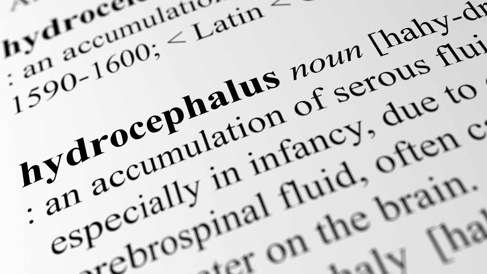 What is Hydrocephalus? Understanding the Condition
