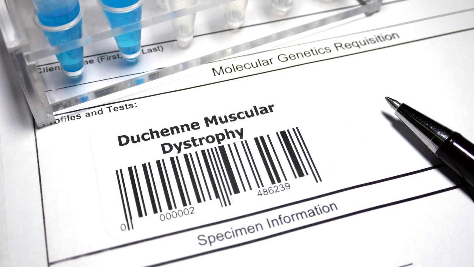 Duchenne Muscular Dystrophy Treatment Options
