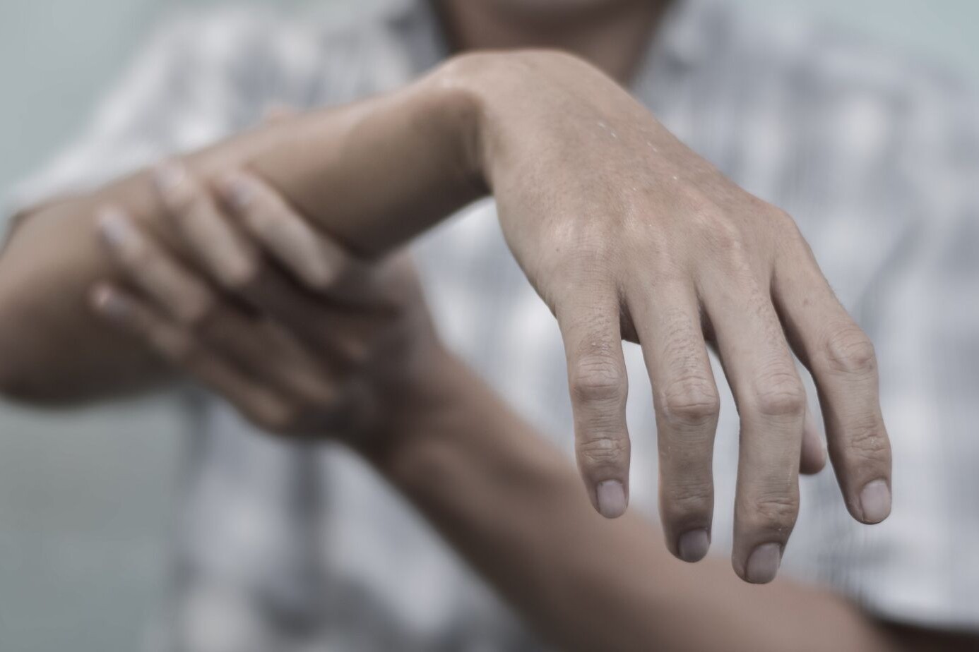 Radial Nerve Palsy: Understanding This Nerve Condition 2 radial nerve palsy