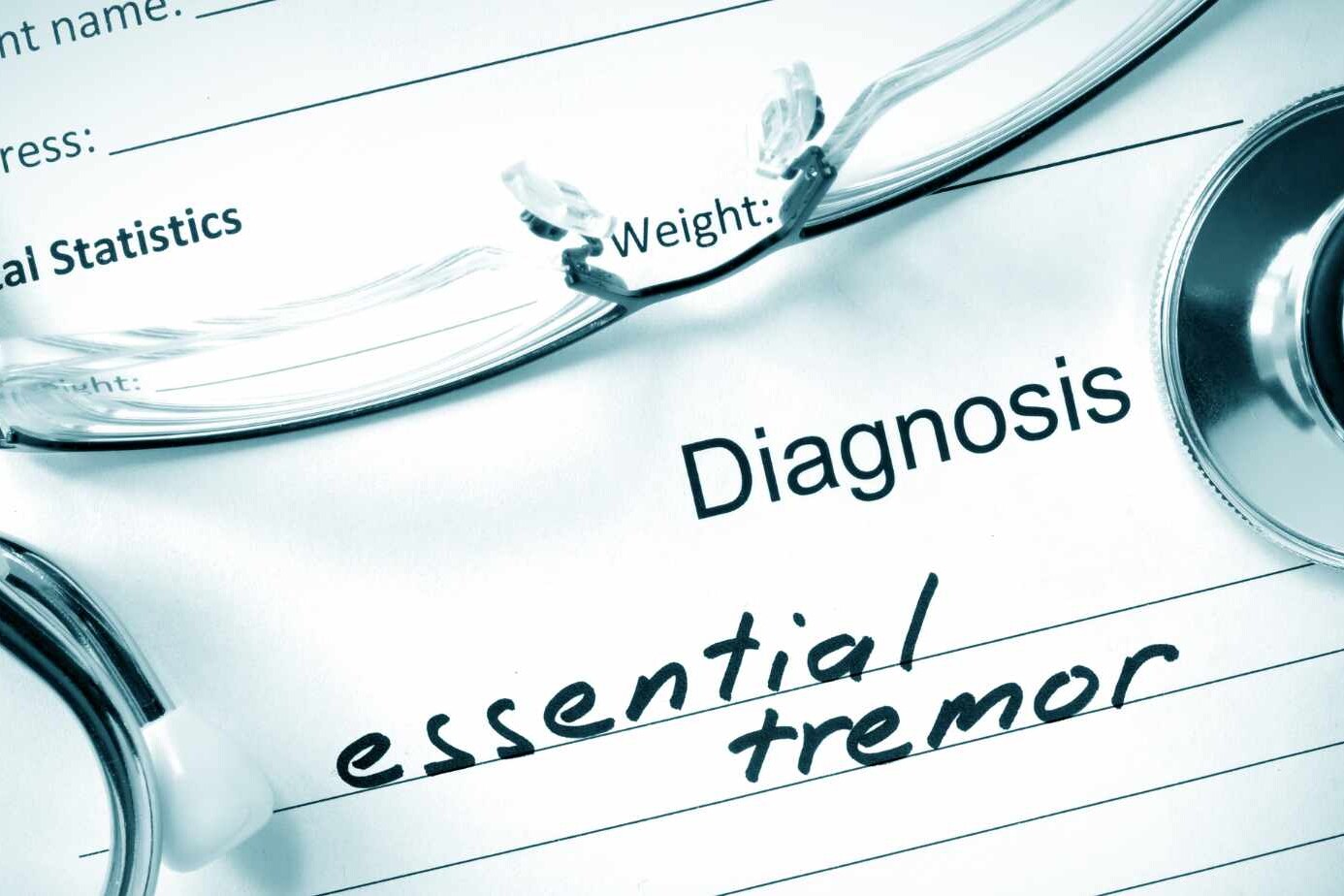 Treatment for Essential Tremor: What Works Best? 3 treatment for essential tremor