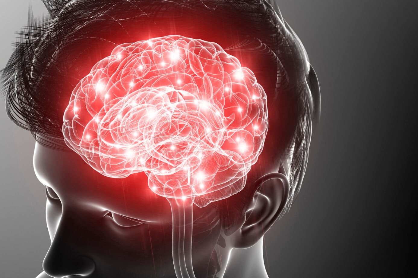 What is Hemiplegia? Defining the Condition 3 what is hemiplegia