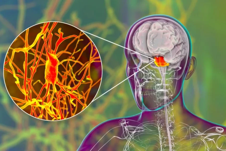 What Is Cerebellar Ataxia? Understanding the Basics 5 cerebellar ataxia