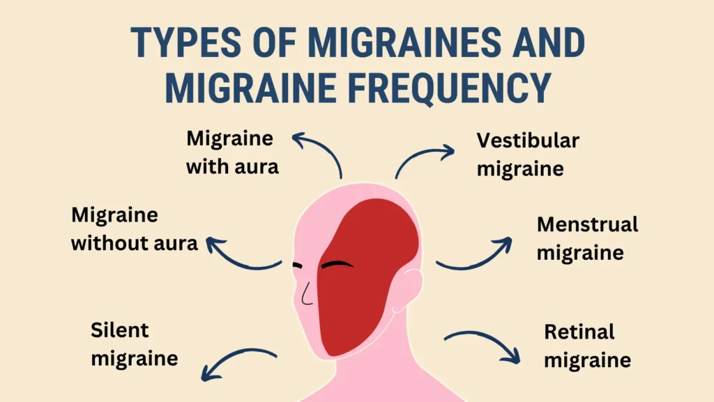 types of migraine headaches​