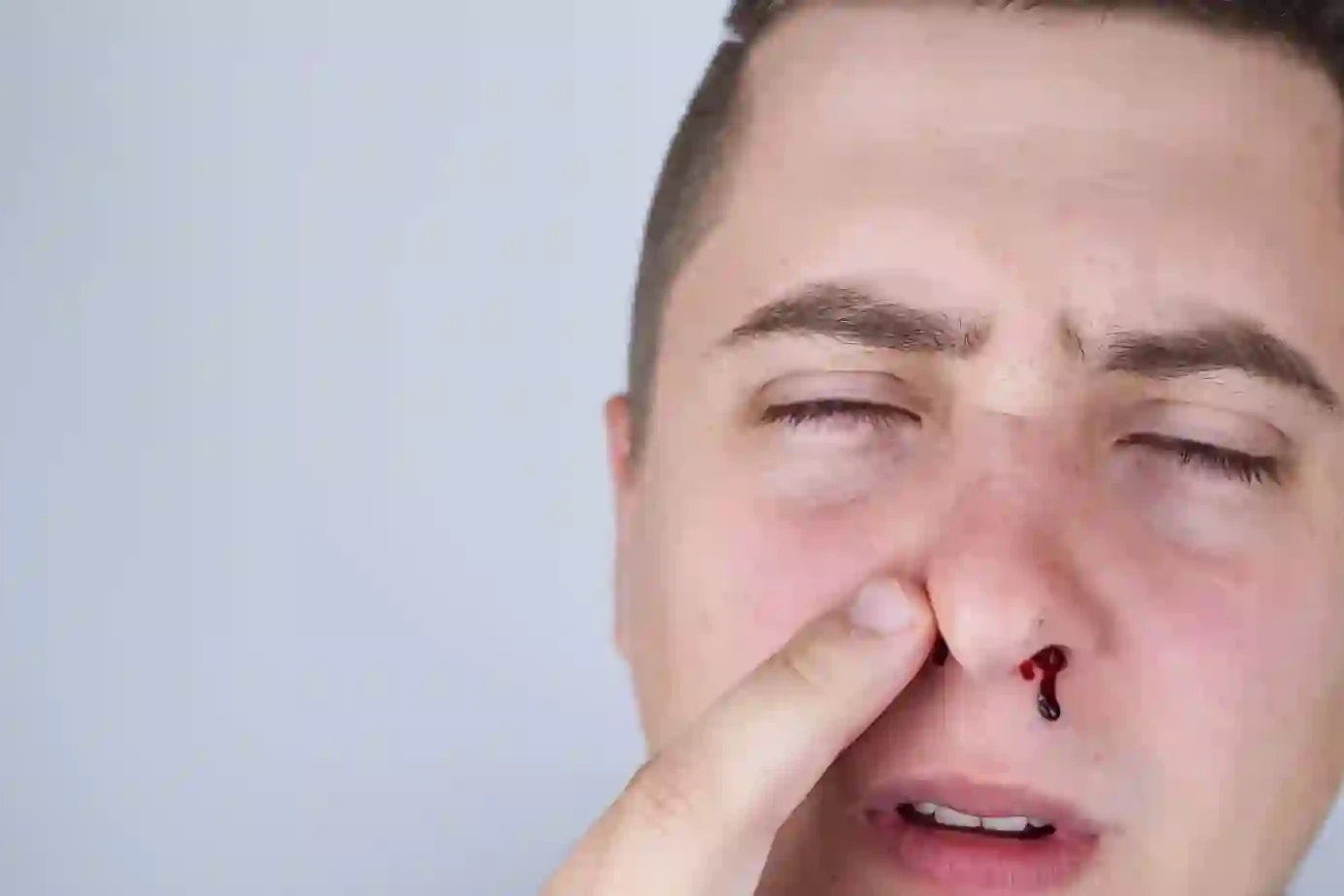 can stress cause nosebleeds