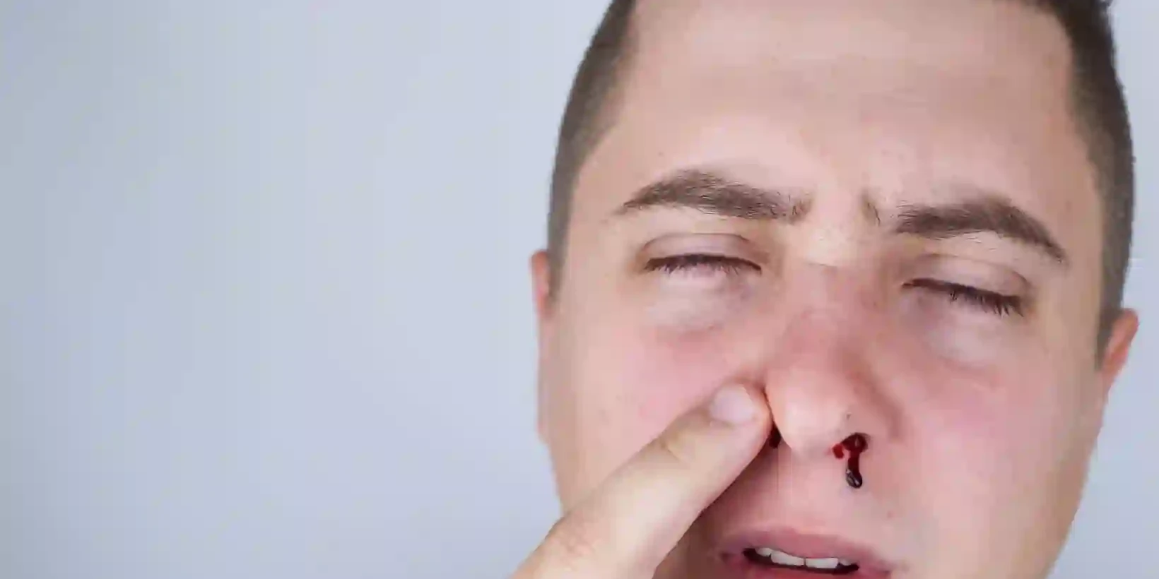 can stress cause nosebleeds