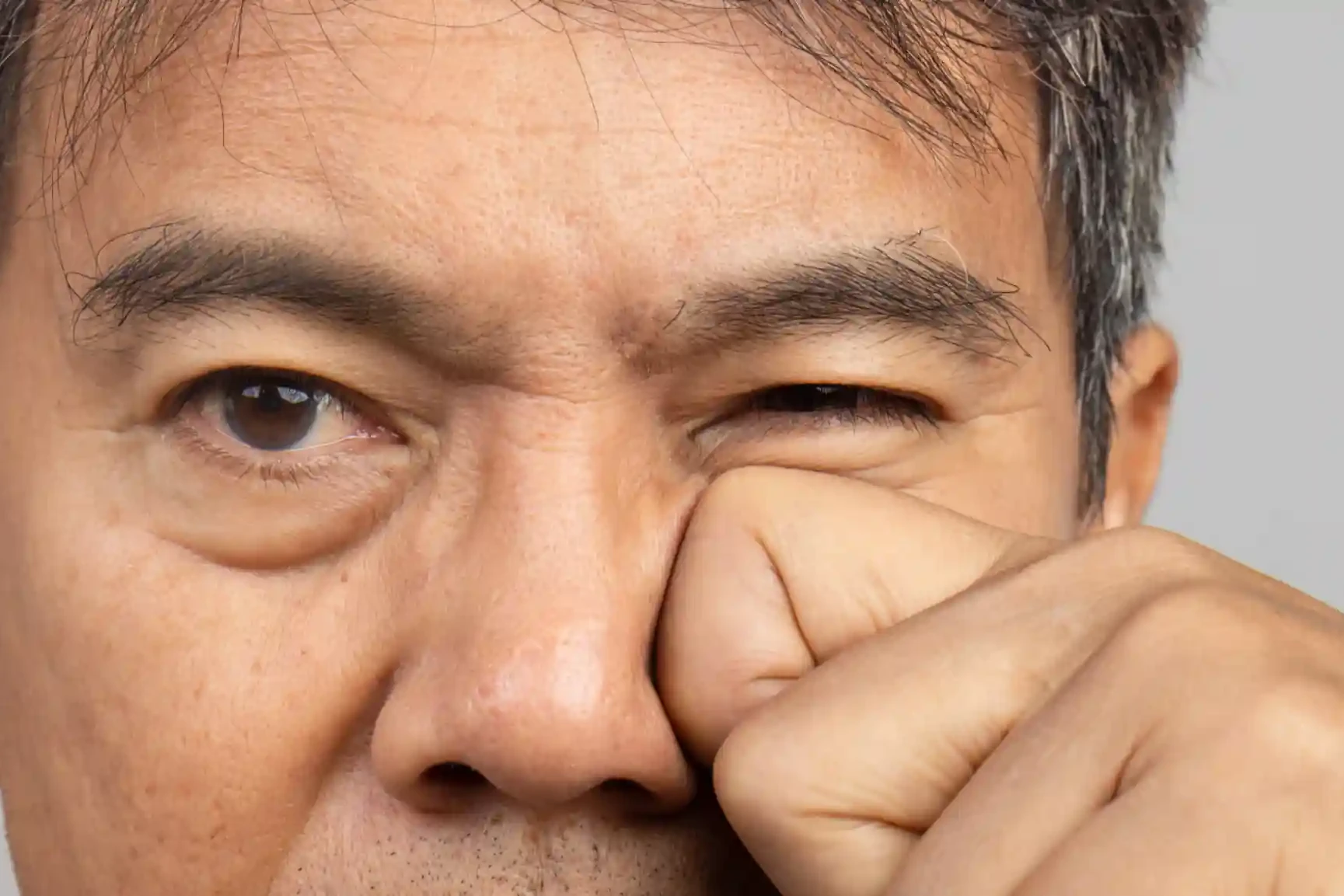 benign essential blepharospasm