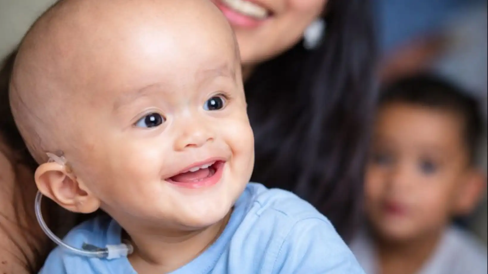 hydrocephalus treatment​