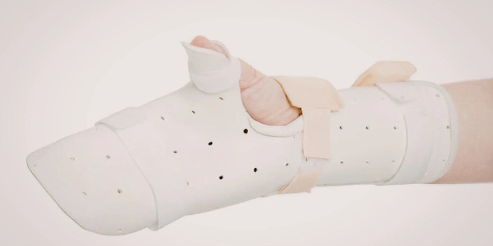 radial nerve palsy splint​